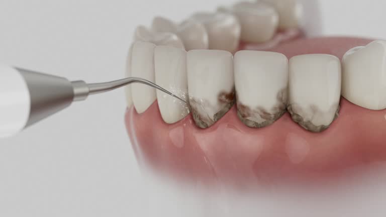 Reliable Dental contractor in Lake of the Woods, IL by Dentist Open Now